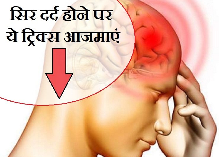 सिर दर्द का घरेलू इलाज | प्रेगनेंसी में सिर दर्द का घरेलू इलाज